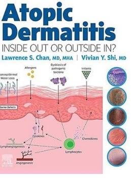 Atopic Dermatitis Inside Out or Outside in 2022（特应性皮炎由内而外或由外而内）