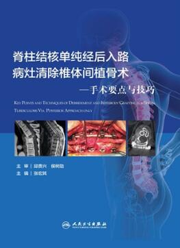 脊柱结核单纯经后入路病灶清除椎体间植骨术 手术要点与技巧