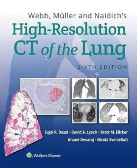 Webb, Muller and Naidich’s High-Resolution CT of the Lung 6th Edition 2021（肺部高分辨率CT 第6版）