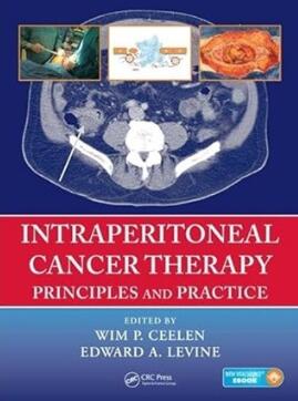 Intraperitoneal Cancer Therapy Principles and Practice（腹膜内癌症治疗原则和实践）