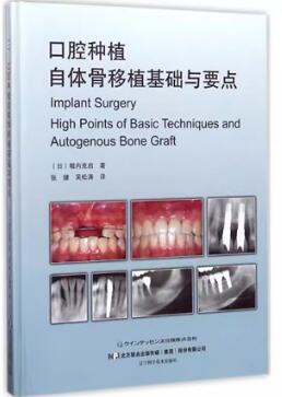 口腔种植自体骨移植基础与要点