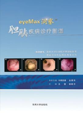 eyeMax洞察TM胆胰疾病诊疗图谱