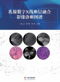 乳腺数字X线断层融合影像诊断图谱