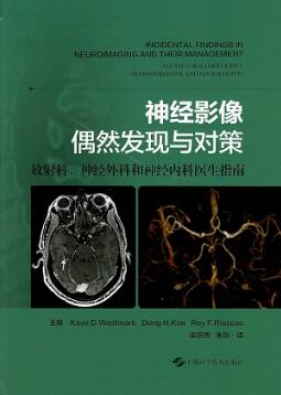 神经影像偶然发现与对策 放射科、神经外科和神经内科医生指南