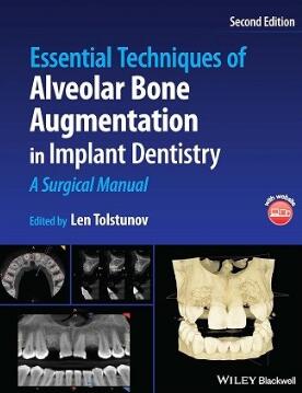 Essential Techniques of Alveolar Bone Augmentation in Implant Dentistry A Surgical Manual 2nd Edition 2022（口腔种植牙槽骨增量基本技术外科手册 第2版）