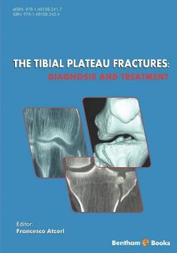 The Tibial Plateau Fractures Diagnosis and Treatment（胫骨平台骨折的诊断和治疗）