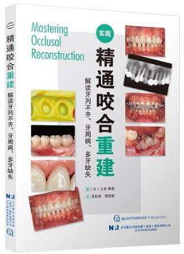 精通咬合重建 解读牙列不齐牙周病多牙缺失