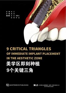 美学区即刻种植9个关键三角