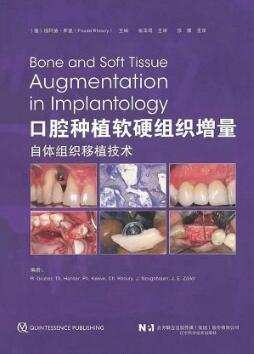 口腔种植软硬组织增量