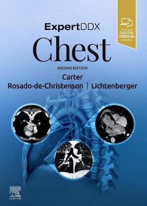 ExpertDDx Chest 2nd Edition 2020（ExpertDDx胸部 第2版）