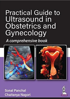 Practical Guide to Ultrasound in Obstetrics and Gynecology_ A comprehensive book 2022（妇产科超声实用指南 一本综合性的书）