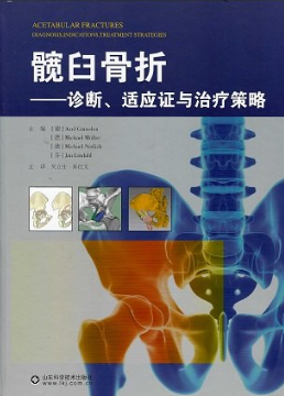 髋臼骨折 诊断、适应证与治疗策略