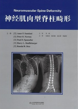 神经肌肉型脊柱畸形