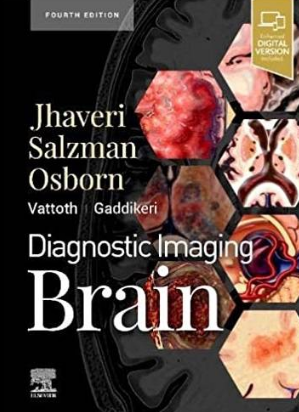 Diagnostic Imaging Brain 4th Edition 2020（ 脑部影像诊断 第4版）