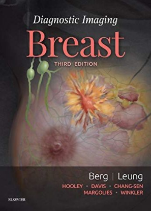 Diagnostic Imaging Breast 3rd Edition 2019（乳腺影像诊断 第3版）