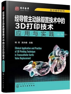 经导管主动脉瓣置换术中的3D打印技术应用与实践