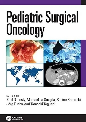 Pediatric Surgical Oncology 2022（小儿肿瘤外科）