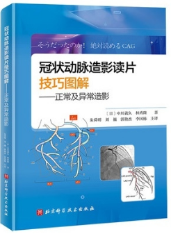 冠状动脉造影读片技巧图解 正常及异常造影