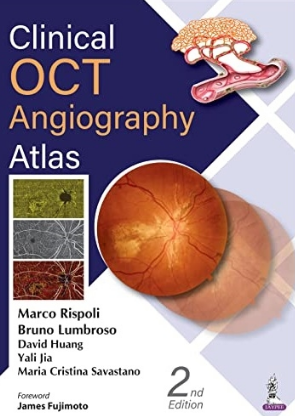 Clinical OCT Angiography Atlas 2nd Edition 2022（临床OCT血管造影图集 第2版）