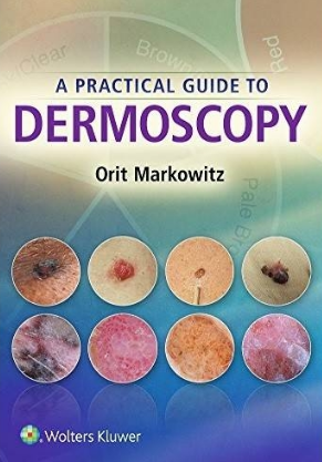 A Practical Guide to Dermoscopy 2017（皮肤镜检查实用指南）