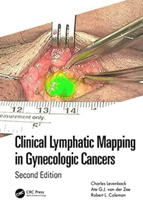 Clinical Lymphatic Mapping in Gynecologic Cancers 2nd Edition 2022（妇科肿瘤的临床淋巴定位 第2版）