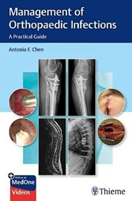 Management of Orthopaedic Infections_ A Practical Guide（骨科感染管理 实用指南）