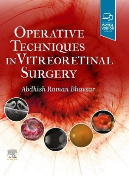 Operative Techniques in Vitreoretinal Surgery 2022（玻璃体视网膜手术的手术技术）