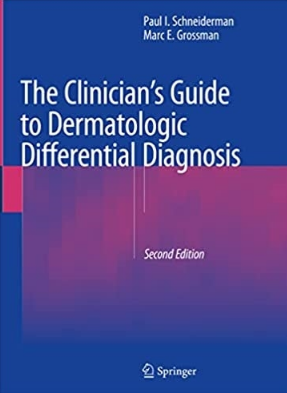 The Clinicians Guide to Dermatologic Differential Diagnosis 2nd Edition 2022（皮肤科鉴别诊断临床医师指南 第2版）