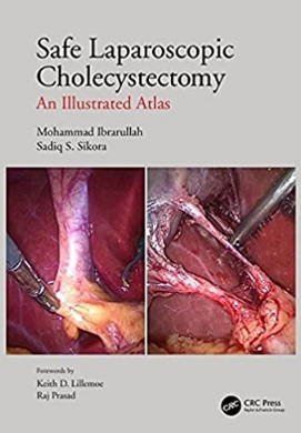 Safe Laparoscopic Cholecystectomy An Illustrated Atlas 2022（低风险腹腔镜胆囊切除术）