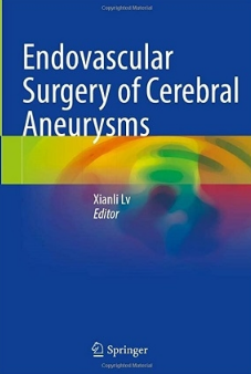 Endovascular Surgery of Cerebral Aneurysms 2022（脑动脉瘤的血管内手术）