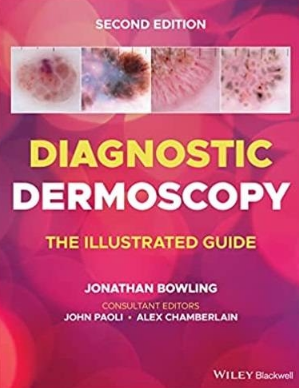 Diagnostic Dermoscopy The Illustrated Guide 2nd Edition 2022（诊断皮肤镜图解指南 第2版）