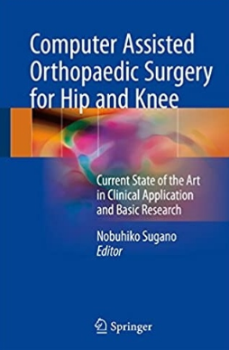 Computer Assisted Orthopaedic Surgery for Hip and Knee（计算机辅助髋膝关节手术）