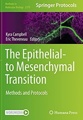 The Epithelial-to Mesenchymal Transition Methods and Protocols 2021（上皮细胞向间充质细胞转化的方法和方案）