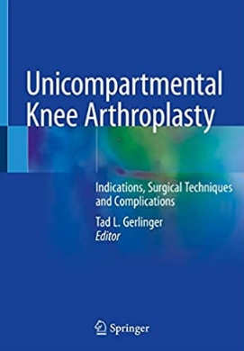 Unicompartmental Knee Arthroplasty Indications, Surgical Techniques and Complications 2020（单髁膝关节置换术适应症、手术技术及并发症）