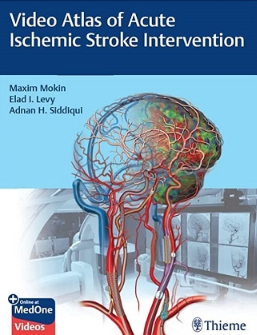 Video Atlas of Acute Ischemic Stroke Intervention 2022（急性缺血性脑卒中介入治疗视频图集）