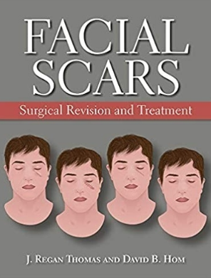 Facial Scars Surgical Revision and Treatment 2019（面部瘢痕手术修复与治疗）