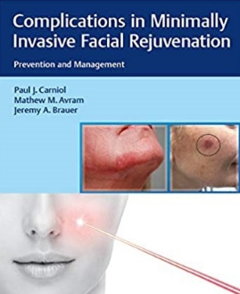 Complications in Minimally Invasive Facial Rejuvenation Prevention and Management 2020（微创面部年轻化并发症的预防和处理）