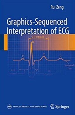 Graphics-Sequenced Interpretation of ECG（心电图图形顺序解读）