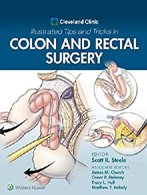 Cleveland Clinic Illustrated Tips and Tricks in Colon and Rectal Surgery 2020（克利夫兰诊所结肠和直肠外科图解和技巧）