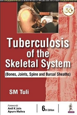 Tuberculosis Of The Skeletal System (Bones, Joints, Spine And Bursal Sheaths) 2021（骨骼系统结核病 骨骼，关节，脊柱和法氏囊鞘）