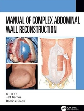 Manual of Complex Abdominal Wall Reconstruction 2021（复杂腹壁重建手册）