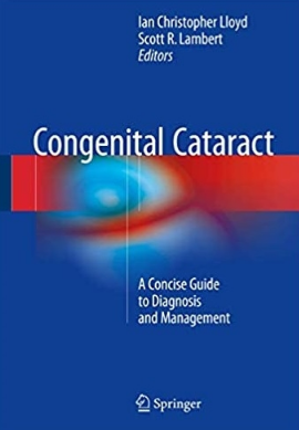 Congenital Cataract A Concise Guide to Diagnosis and Management（先天性白内障诊疗精）