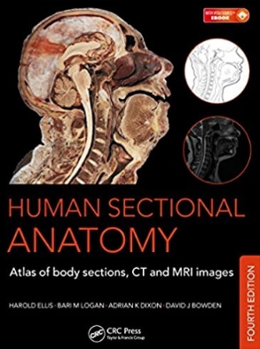 Human Sectional Anatomy Atlas of Body Sections, CT and MRI Images, Fourth Edition（人体CT、MRI及断层解剖对照图谱 第4版）