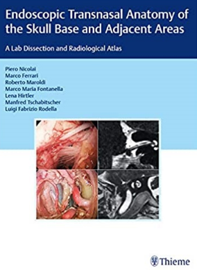 Endoscopic Transnasal Anatomy of the Skull Base and Adjacent Areas A Lab Dissection and Radiological Atlas（经鼻内镜颅底及周边解剖 实验室解剖与影像图谱）