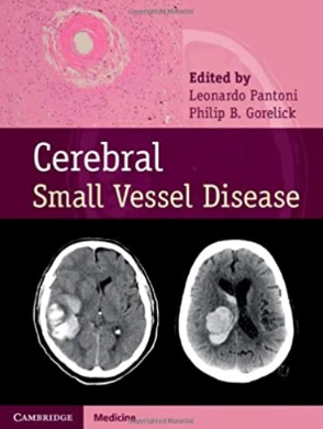 Cerebral Small Vessel Disease（脑小血管病）