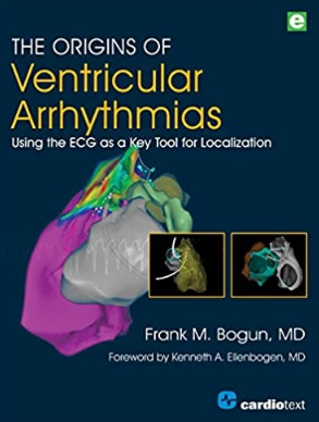 The Origins of Ventricular Arrhythmias Using the ECG as a Key Tool for Localization Volume 1（用心电图作为定位的关键工具研究室性心律失常的起源 第1卷）