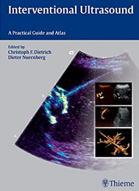 Interventional Ultrasound_ A Practical Guide and Atlas（介入性超声 实用指南和图谱）