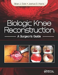 Biologic Knee Reconstruction: A Surgeon's Guide