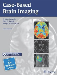 Case-Based Brain Imaging