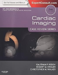 Cardiac Imaging: Case Review Series